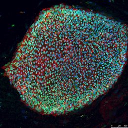 Colonia de células madre pluripotenciales