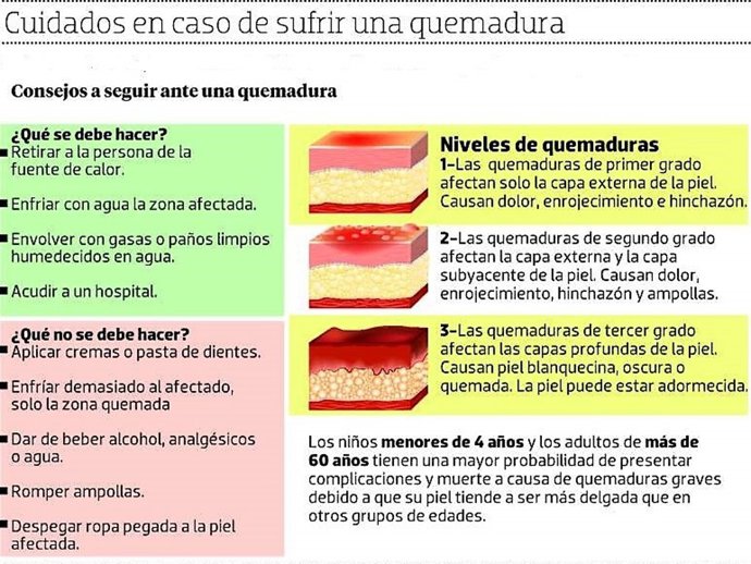 Consejos ante quemaduras