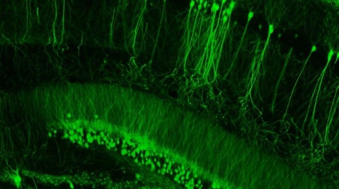 Imagen de microscopía que muestra las células del hipocampo de un ratón