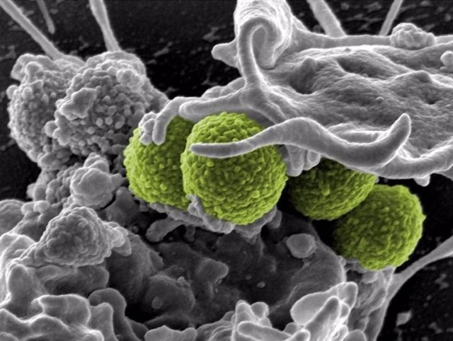 Staphylococcus aureus interactúa con una célula inmune, estafilococo