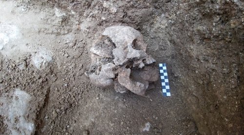 Cráneo del niño con la piedra en su boca