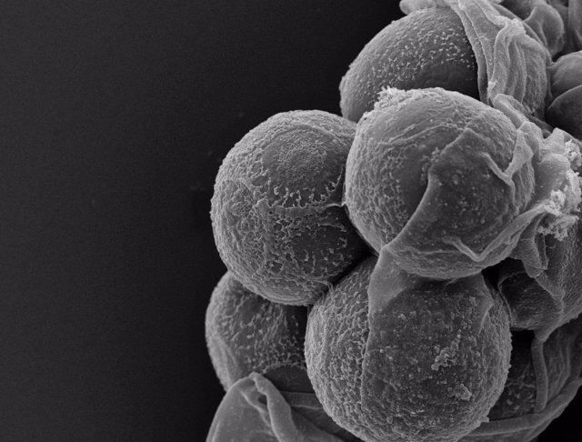 Organismo en el que se ha hallado microRNA, la Sphaeroforma arctica