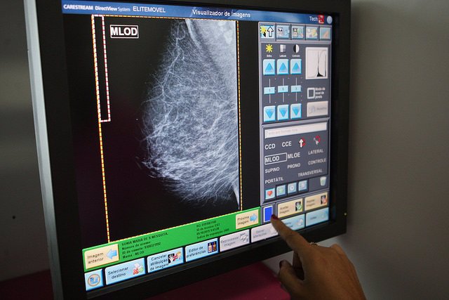 Mamografia bat