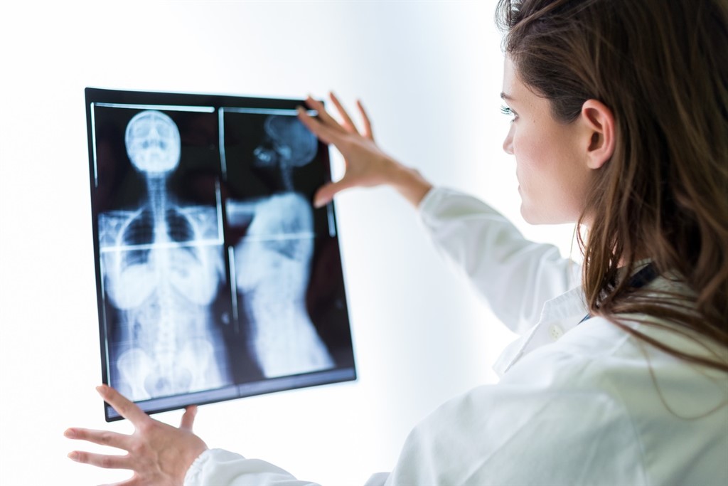 Cuanto Vive Una Persona Con Cancer De Pancreas