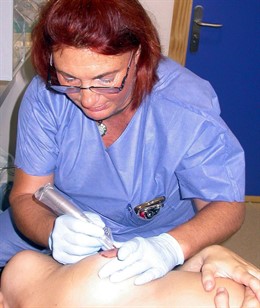 Micropigmentación aerolar realizada en el Valme