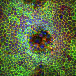 Células superdeformables