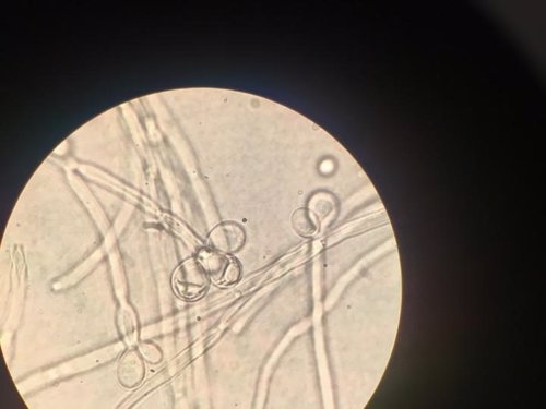 Células de la levadura Ambrosiozyma monospora