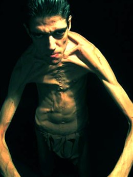 Javier Botet