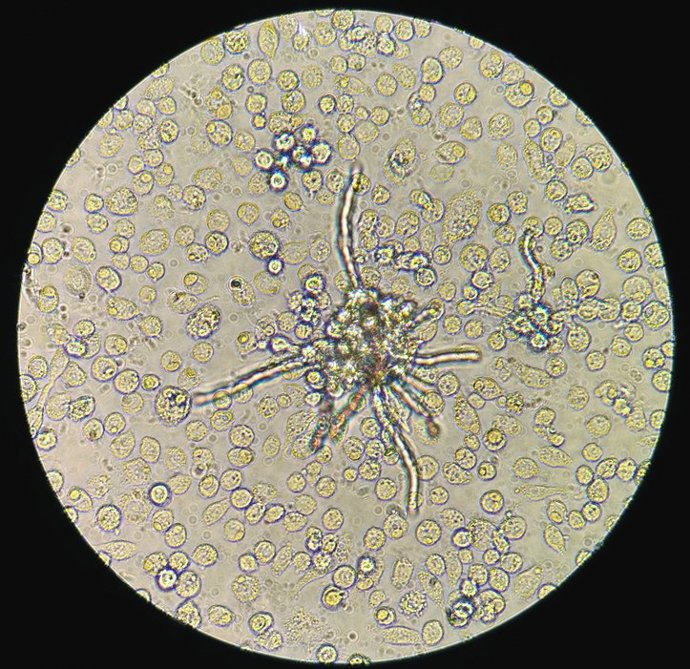 Imagen hongo sobreviendo al ataque de macrófagos