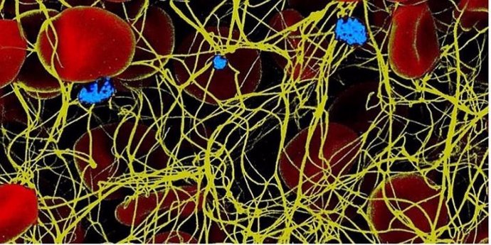 Coágulo de sangre visto al microscopio electrónico