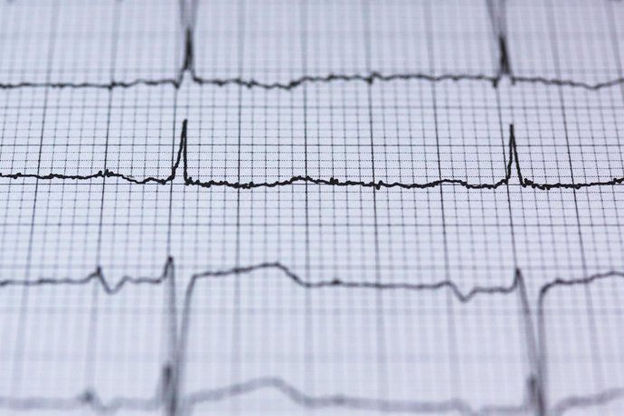 Electrocardiograma