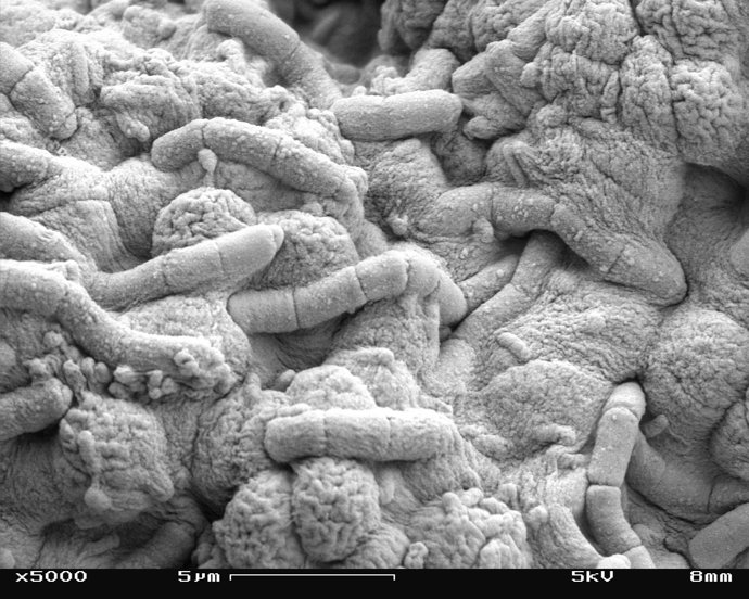 Bacterias
