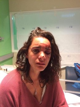 Andrea Sicignano AGREDIDA