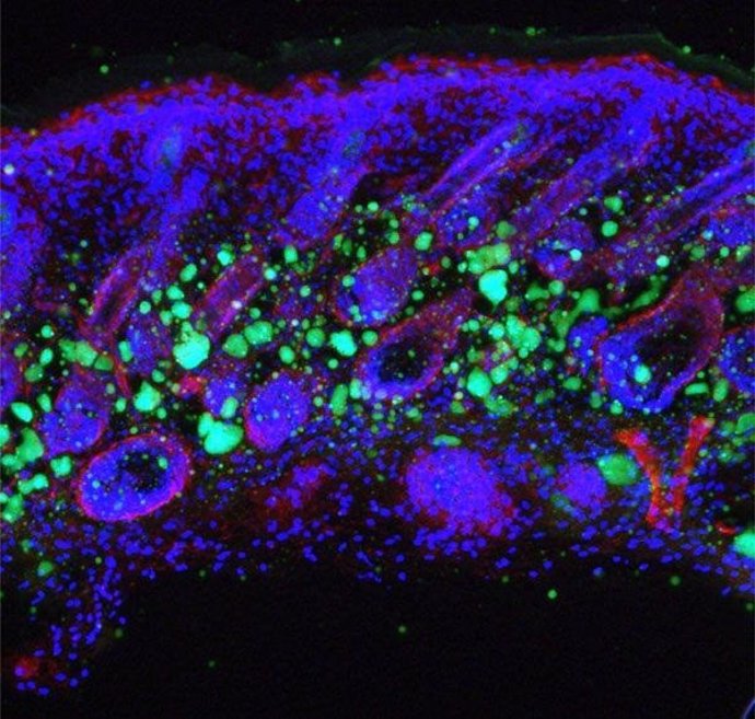 Células de la piel en azul y las células de grasa en verde