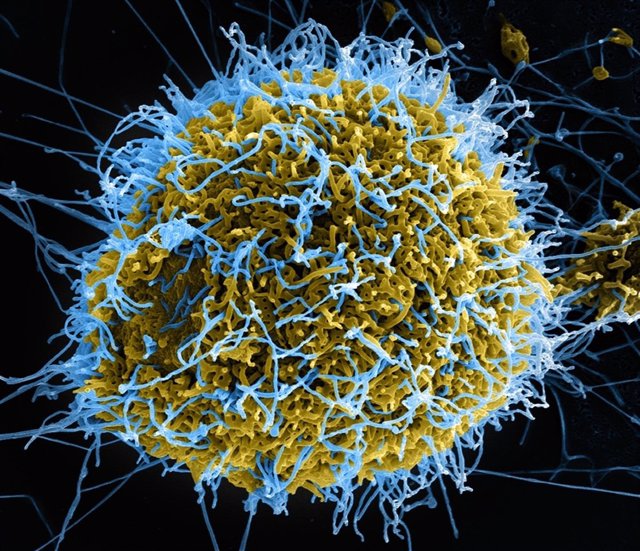 Filamentos del virus del ébola