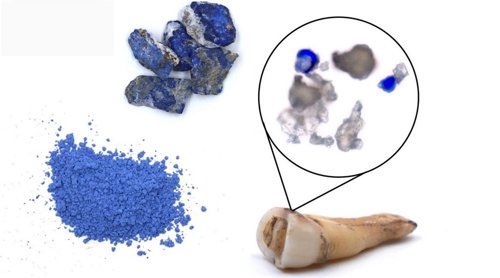 Pigmento detectado en la placa dental