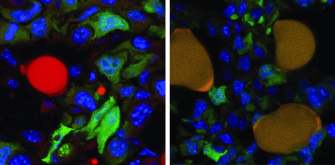 Células cancerosas antes y después de tratamiento