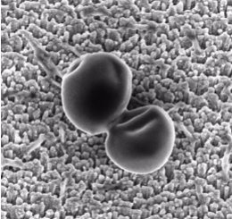 Imágenes de microscopía electrónica de barrido de dos Staphylococcus aureus sobr