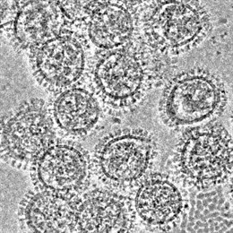 Microscopía crioelectrónica de virus de gripe A