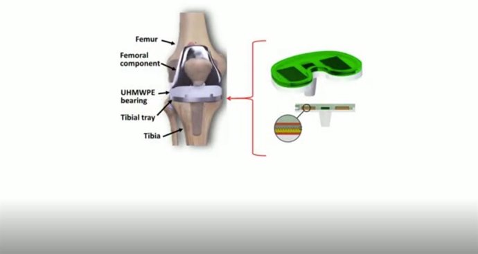 Prótesis de rodilla inteligente