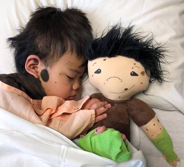 Una muñeca como yo: Una iniciativa que fabrica muñecas con las mismas discapacid