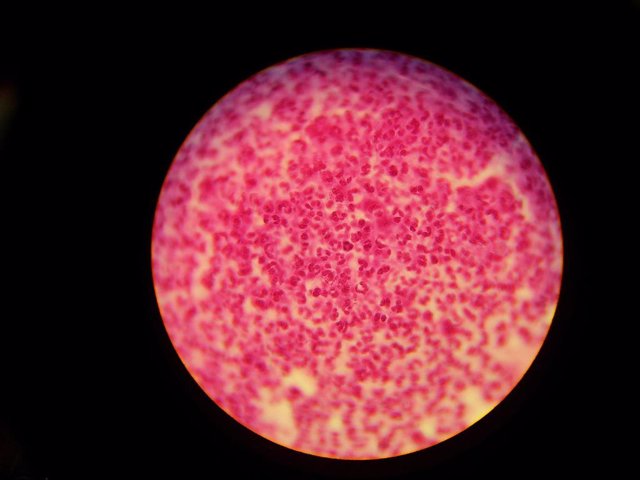 Gonorrea, Neisseria gonorrhoeae
