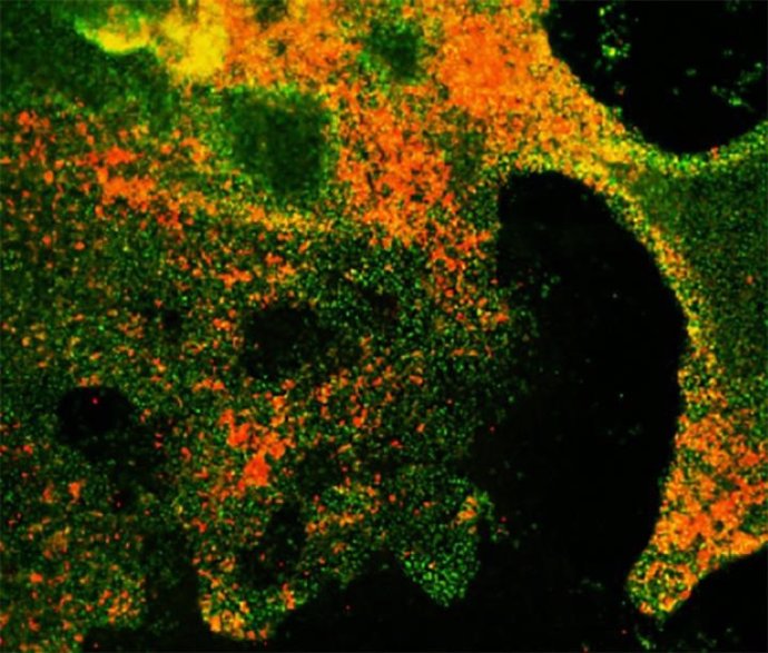 Formación de células neuroendocrinas de progenitores de pulmón