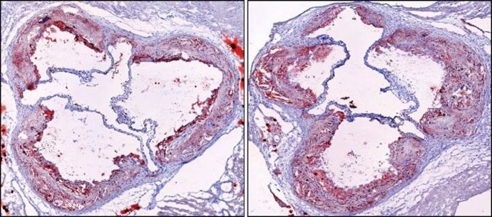 Arterias de ratón antes y después de la fragmentación del sueño