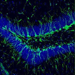 Una investigación Complutense revela mecanismos que explican el deterioro cognit