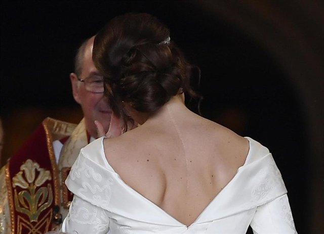 ¿Me Puedo Deshacer De Las Cicatrices Que Tan Poco Me Gustan?