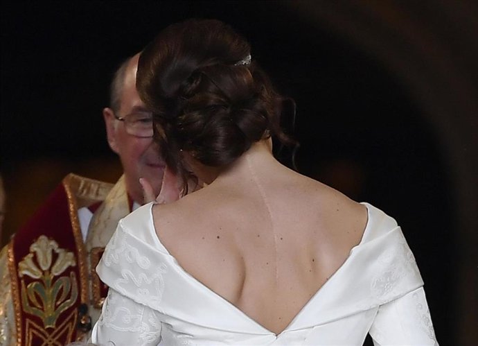 ¿Me Puedo Deshacer De Las Cicatrices Que Tan Poco Me Gustan?