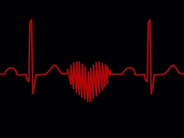 Corazón, paro cardiaco, electrocardiograma