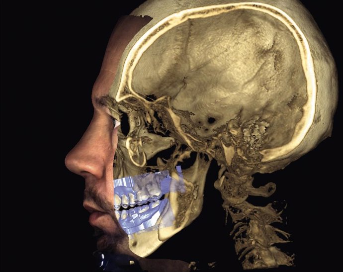 Empresas.- El Hospital La Luz incorpora un escáner facial 3D