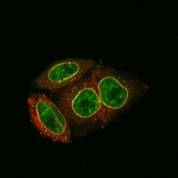Identifican cómo impedir que el ADN del VIH entre al núcleo celular