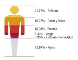 Canarias registra cerca de 11.400 casos de cáncer en 2018, más de la mitad en ho