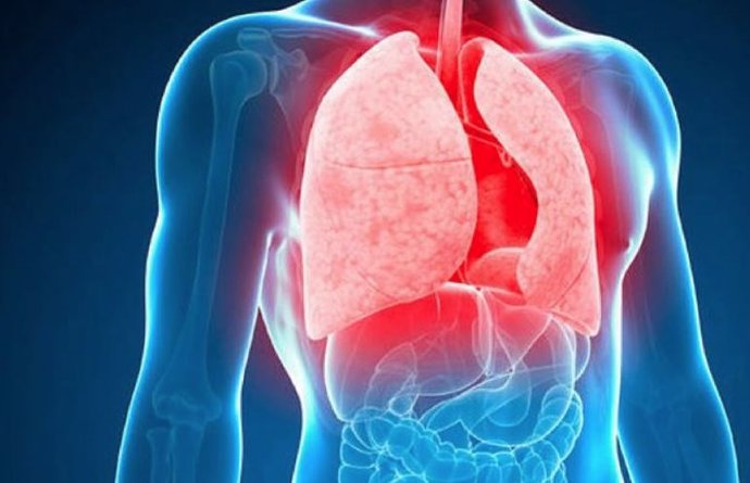 24 De Marzo: Día Mundial De La Tuberculosis, ¿Qué Sabes De Esta Enfermedad?