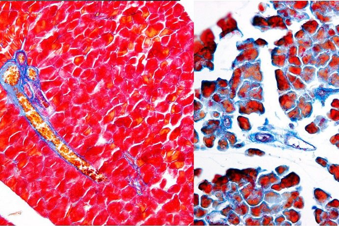 Málaga.- Investigadores de la UMA revelan un nuevo mecanismo molecular implicado