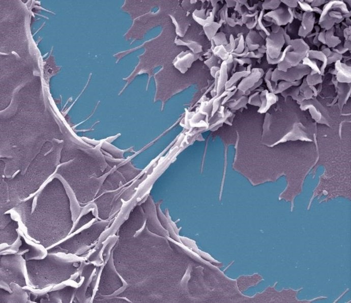 Francia.- El VIH se mueve entre las células a través de nanotubos en presencia d