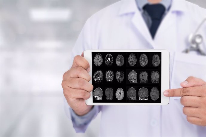 La estimulación de las ondas cerebrales puede mejorar los síntomas del Alzheimer