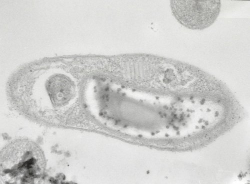 Descubren en Siberia la buscada bacteria capaz de vivir en Marte