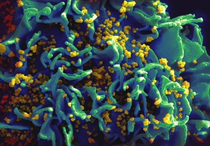 EEUU.- El microbioma intestinal puede contribuir a la transmisión del VIH en hom