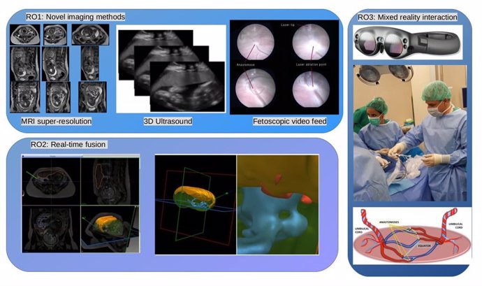 Un proyecto usa inteligencia artificial para ayudar en una intervención compleja