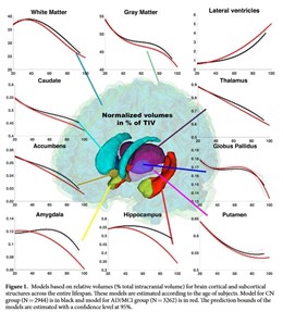 Investigadores describen cómo cambia el cerebro años antes de los primeros síntomas del alzhéimer