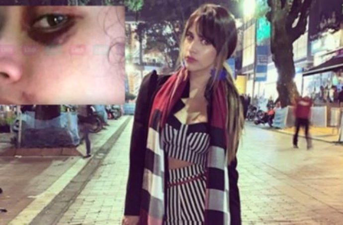 La actriz colombiana Zulma Rey publica fotos tras sufrir una brutal paliza supuestamente por su exnovio