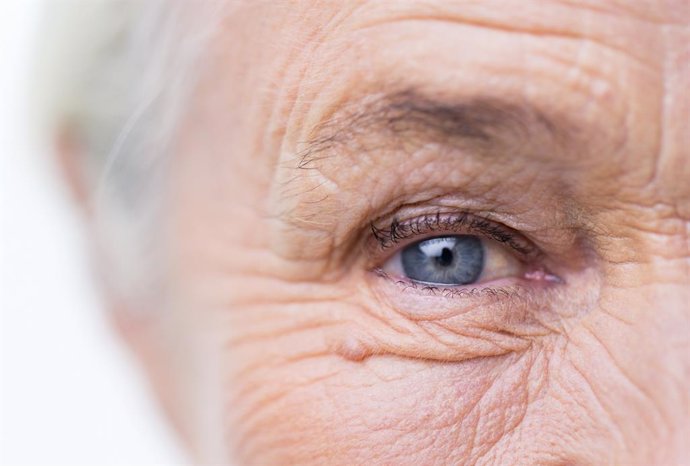 Un oftalmólogo podría en un futuro diagnosticar la enfermedad de Alzheimer antes de que aparezcan síntomas