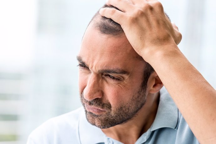Técnicas contra la alopecia: ¿Podré dejar de perder pelo y recuperar lo perdido?
