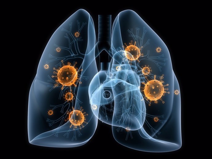 Investigadores detectan alteraciones en los niveles de metales en las células de enfermos de cáncer de pulmón