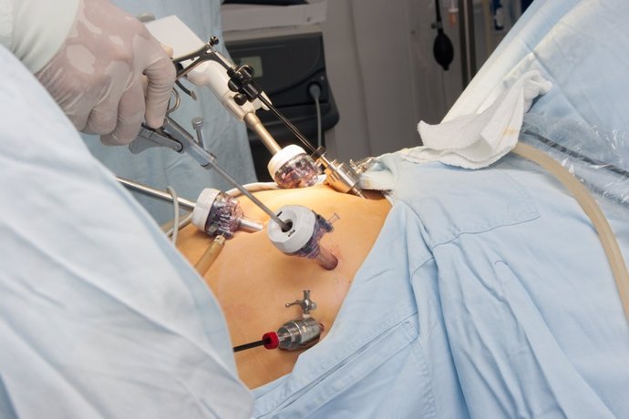 8 ventajas de la cirugía laparoscópica