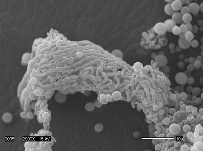 Secuenciado completamente el patógeno mortal cryptococcus