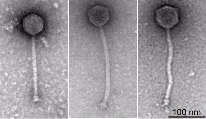 Reino Unido.- Científicos emplean una terapia con fagos para tratar infecciones bacterianas resistentes a los medicament